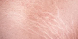 Γεωργία Παπαδάκη. ΡΑΓΑΔΑ