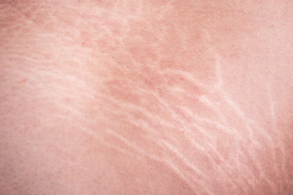 Read more about the article Γεωργία Παπαδάκη. ΡΑΓΑΔΑ